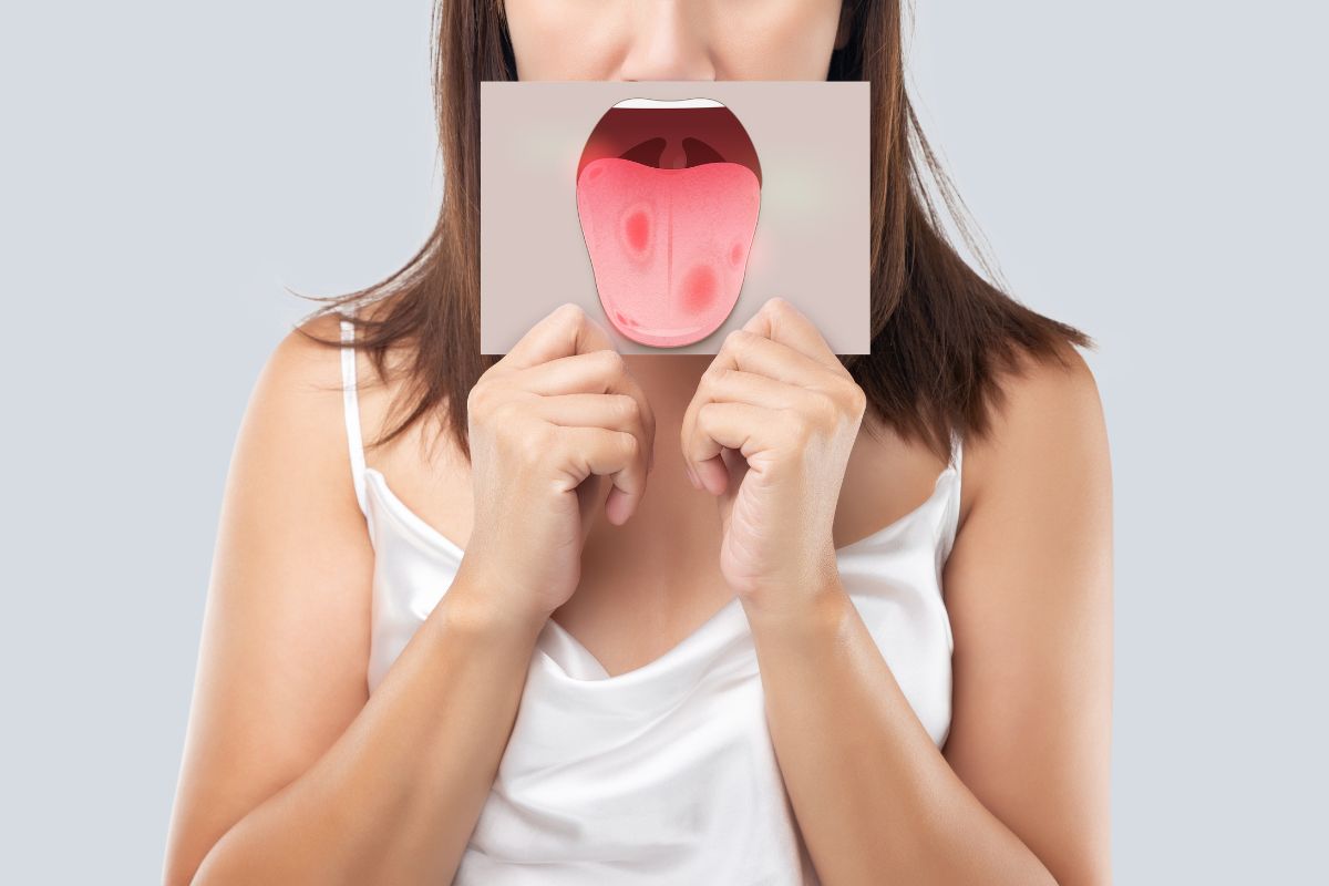 Tongue Cancer Symptoms: Early Signs, Causes, Treatment and When to Get Checked 3 How to lower your risk of tongue cancer