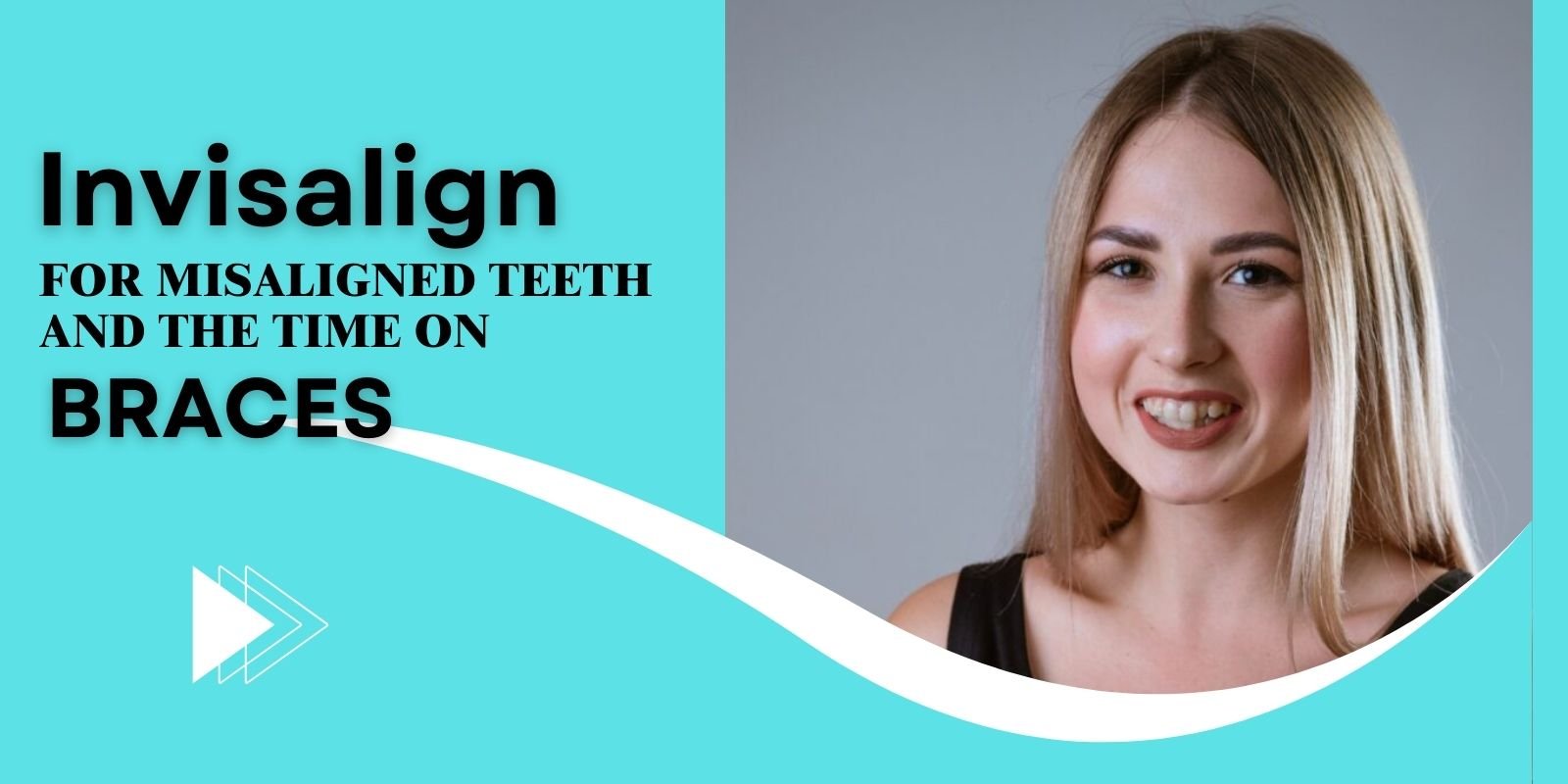 Invisalign for misaligned teeth and the time on braces