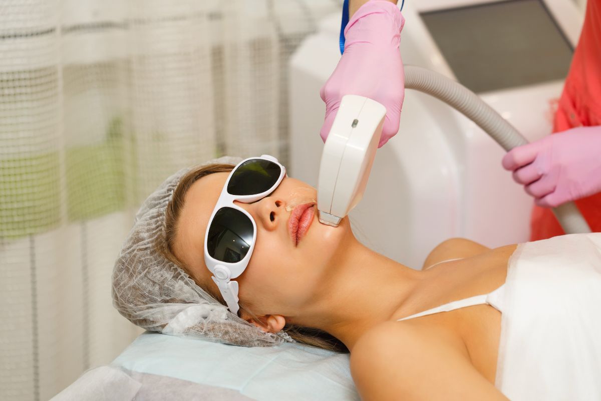 Facial Laser Hair Removal vs Waxing: Which Is Better for You? 1 How each method works